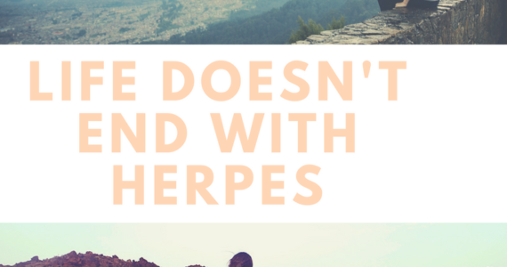 herpes