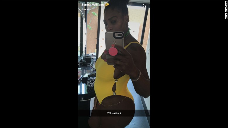 serena williams pregnant